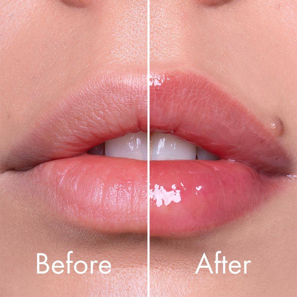 WELL 01 Lip plumper